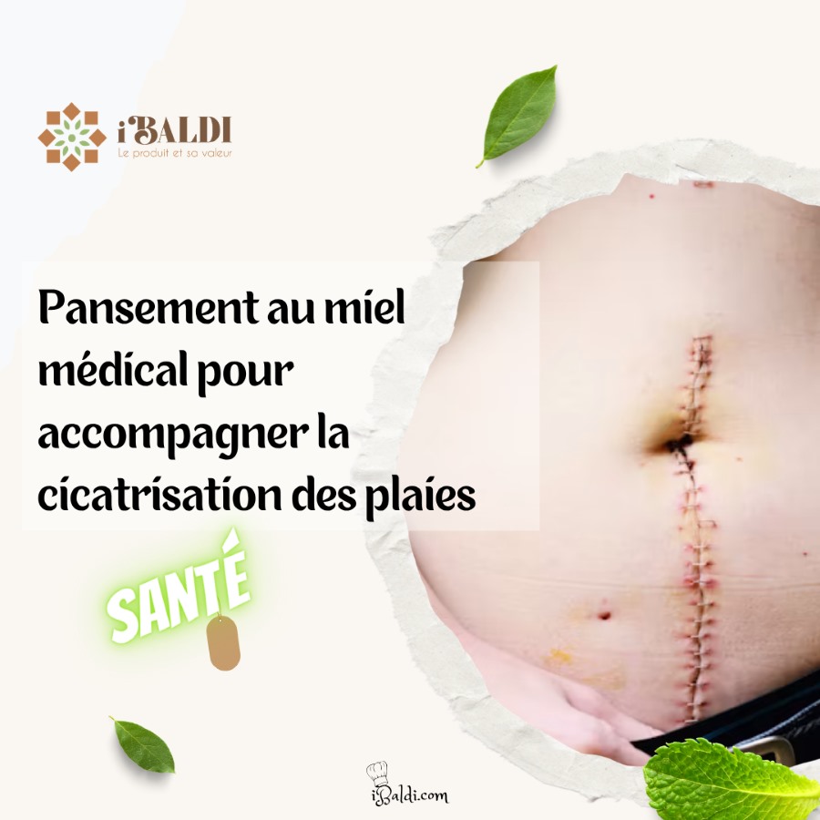 Pansement au miel médical pour accompagner la cicatrisation des plaies
